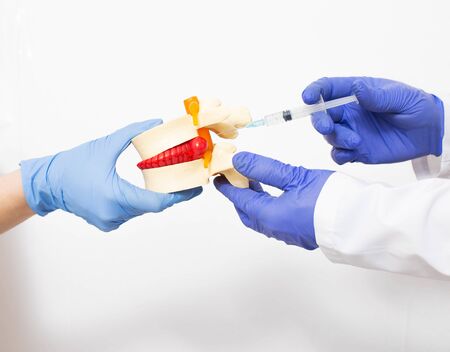 Doctor neurologist holds a mock spine with intervertebral hernia. The doctor makes the Paravertebral block into a hernia of the spine. The concept of treating a hernia of the back with the injection of chondroprotectors and anti-inflammatory drugs, vertebral columnの写真素材