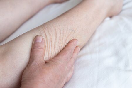An elderly woman touches dry skin on her calves. The concept of skin diseases, lack of vitamins,...