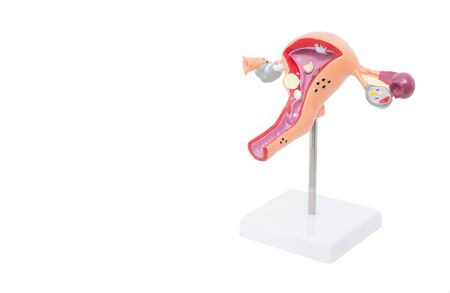Mock reproductive female system on a white background. The concept of female diseases in gynecology, bacterial vaginosisの写真素材