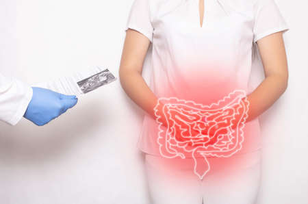 The doctor holds the results of the examination of the female patient on a white background. Bowel inflammation and disease concept, abdominal pain, dolichosigmaの写真素材