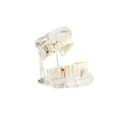 model of a dental jaw on a white background, isolate. Dentistryの写真素材