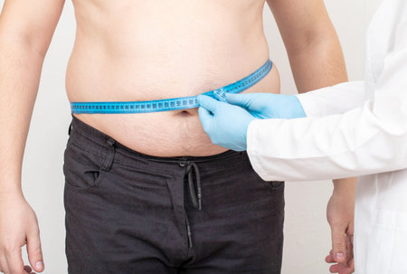 Doctor nutritionist measures the big fat belly of a male patient with a measuring tape. weight loss and healthy lifestyle conceptの写真素材