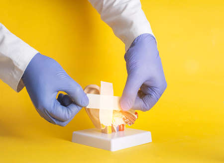 Doctor glues a plaster on a mock-up of a human ear on a yellow background. Hearing treatment and...