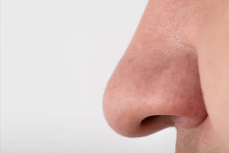 A man has a wide fleshy big nose, close-up. Nose reduction plastic surgery concept, copy space for...