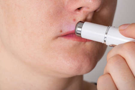 Girl treats inflamed red acne on the skin of the face with a laser cosmetic pen, cosmetic procedure....