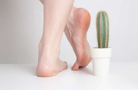 Cactus near the legs of the girl on a white background. Concept of stitching pains and discomfort in...