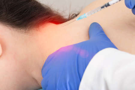The doctor makes the procedure of local injection therapy of blockade in the occipital region of the head. Kotsnept treatment of diseases of the occipital nerve and pain in the head, muscle tensionの写真素材