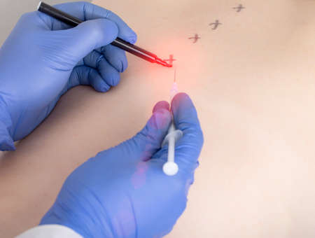 The doctor injects the patient with an anti-inflammatory drug at the trigger points. Treatment of...