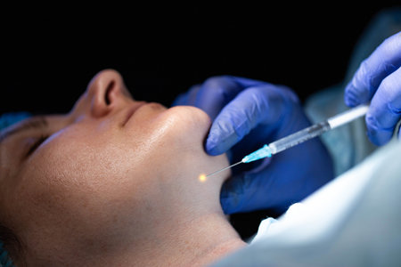 Doctor cosmetologist makes lipolytic injections to the patient's girl to eliminate the double chin. Modern method in cosmetologyの写真素材
