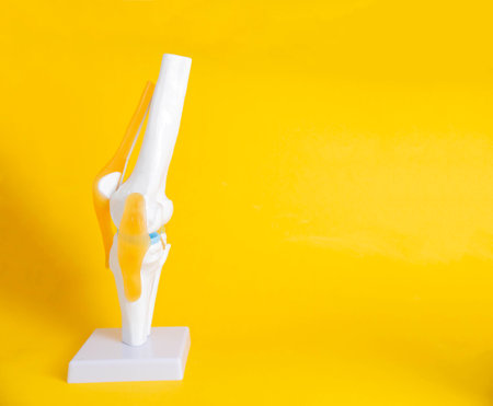 Knee joint mockup on yellow background. Concept of knee arthroplasty with implants. Copy space for text, orthopedicの写真素材