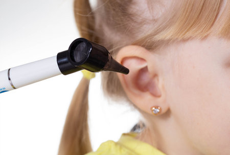Doctor ENT doctor conducts an otoscopy with a device, close-up. Treatment and routine examination of the ear membranes and ear canals.の写真素材