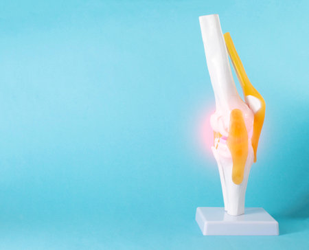 Model of a human knee joint on a blue background. Inflamed knee treatment, pain. Copy space for text, close-upの写真素材