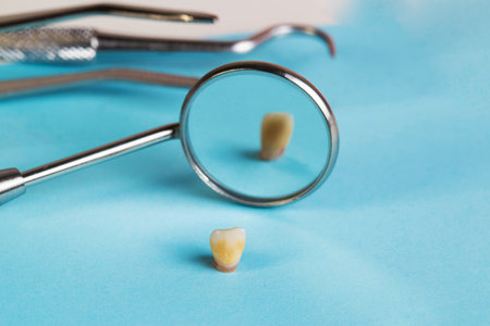 dental mirror, dental instruments and milk baby tooth on a blue background. The concept of pediatric dental surgery. Removal of milk teeth.の写真素材