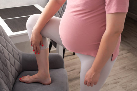 Pain and fatigue in the legs of a pregnant girl. Varicose veins of the lower extremities. The girl put her feet on the chair. Convulsions and spasm, musclesの写真素材