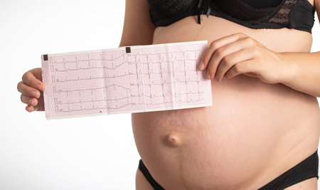 A pregnant girl holds a cardiogram against the background of her stomach. The concept of cardiac abnormalities in girls during pregnancy. Tachycardia and heart block.の写真素材