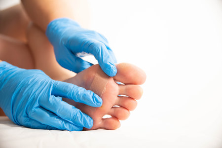 A doctor covers calluses on a person s foot with a special plaster. Copy space for textの写真素材