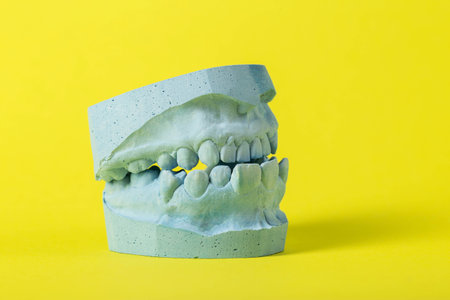 Blue cast of a dental jaw on a yellow background, close-up. Concept of taking dental impressions for making crowns for dental prosthetics, technicianの写真素材