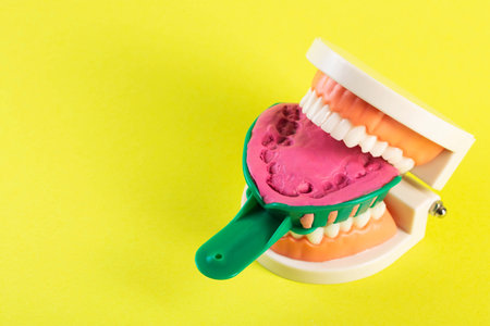 Green dental spoon for taking a dental impression in a mock-up of a dental jaw on a yellow background. Making an artificial jaw for malocclusion. Manufacturing of dental prostheses, orthodontics in dentistry. Copy space for textの写真素材