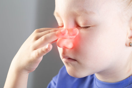 A girl is holding her red nose whose skin is irritated due to a runny nose. Pain in the maxillary...