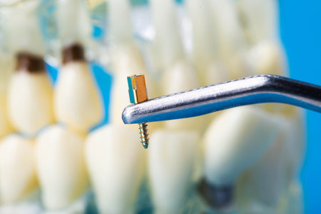 A dental metal pin in tweezers against the background of a medical model of a dental jaw. The concept of installing a dental crown on a post in orthodontics.の写真素材