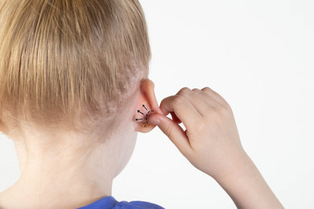 The girl holds her hand on her protruding ear with marks for plastic surgery. Changes in the shape of the pinna and ear. Pediatric otoplasty.の写真素材