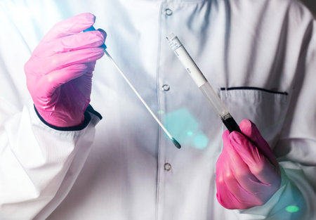 Doctor gynecologist with a medical probe to collect infections from the cervical canal in women for hidden infections. Sexually transmitted infectionsの写真素材