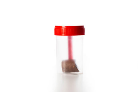 Sterile container with stool test on a white background, isolateの写真素材