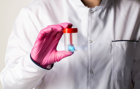 A doctor laboratory assistant holds in his hand a stool test for dysbacteriosis and helminths....