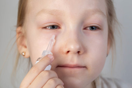 A caucasian girl holds eye drops near her face, close-up. Disease concept conjunctivitis and dry eye syndrome, viral and bacterial infection, allergyの写真素材