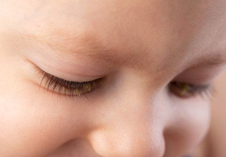 Pus in a little boy's eyes. Concept of bacterial and viral conjunctivitis in children.の写真素材