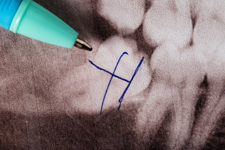 Pen and crossed out wisdom teeth on a dental x-ray, removal of wisdom teethの写真素材