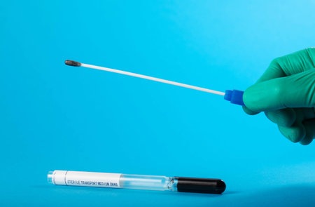 The doctor holds a sterile probe for a smear on a blue background, worms. Treatment of roundworms...