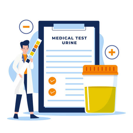 Flat design of urine test for medical and healthcare. Illustration for websites, landing pages, mobile applications, posters and banners. Trendy flat vector illustrationのイラスト素材