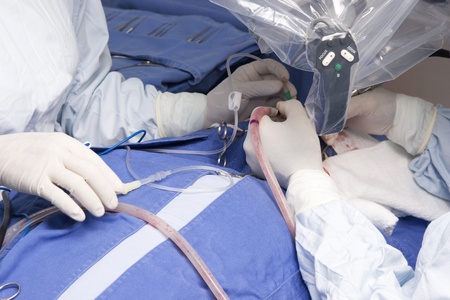Preparation for the beginning of surgical operation with a cut