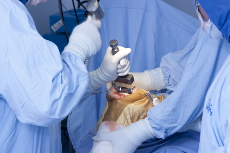 Detail of Surgery, Orthopedic Operation, Knee Surgeryの写真素材
