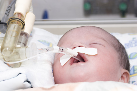 Portrait of newborn baby sleeping inside incubatorの写真素材