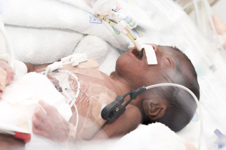 Portrait of newborn baby sleeping inside incubatorの写真素材