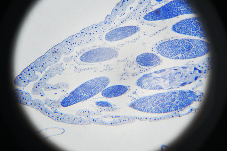 Microscopic photography. Grasshopper meiosis.の写真素材