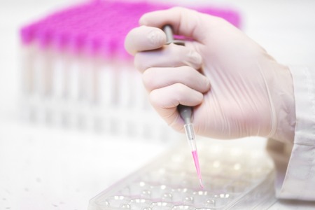 Close up scientist hand holding pipette making for biochemistry test at laboratory department in hospital.の写真素材