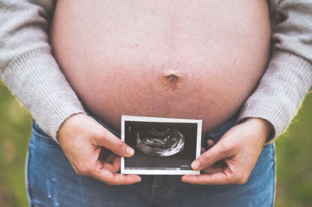 A pregnant woman is holding a photo of her baby, Ultrasound picture. outdoors.の写真素材