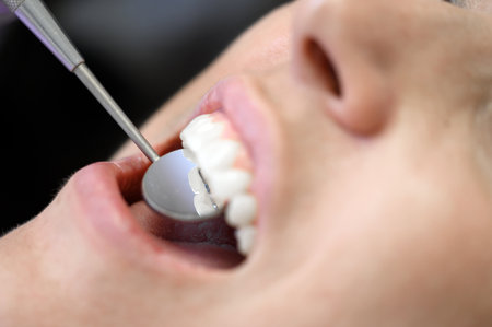 Extreme close up of beautiful young girl having dental check up.の写真素材