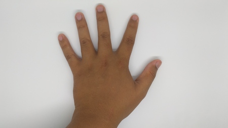 five fingers