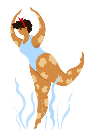 Dark skin girl with vitiligo in yoga poseのイラスト素材
