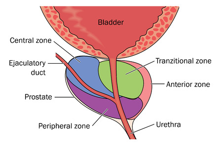 The prostate gland showing its position relative to the bladder and urethra and the zones of the prostate in cross sectionのイラスト素材