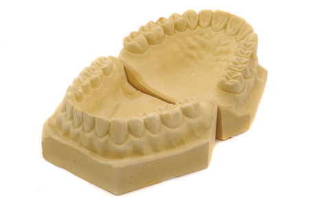 A perfect upper jaw and lower jaw gypsum model