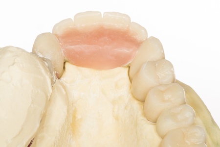 denture
