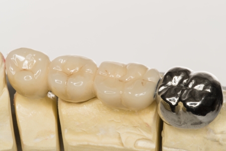 dentureの写真素材