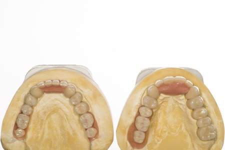 denture