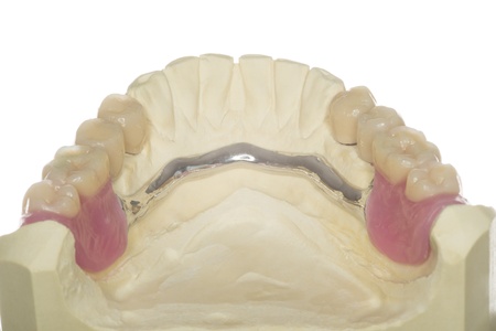 denture