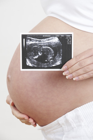 Close Up Of Pregnant Woman Holding Ultrasound Scanの写真素材